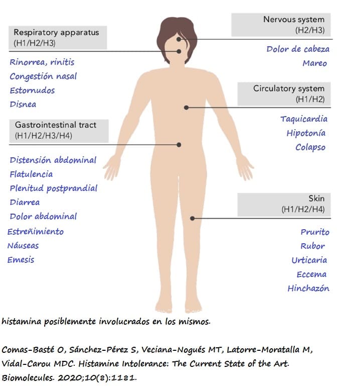 Representación gráfica de los síntomas más habituales, clasificados por tejidos y sistemas, en la intolerancia a la histamina