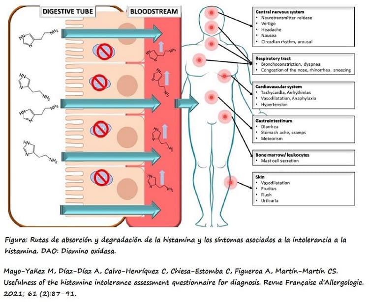 Rutas de absorción y degradación de la histamina y síntomas asociados a la intolerancia a la histamina