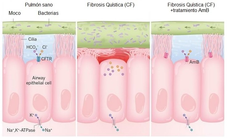 Pulmones de un sujeto sano, con CF y con CFa tratamiento con AmB 