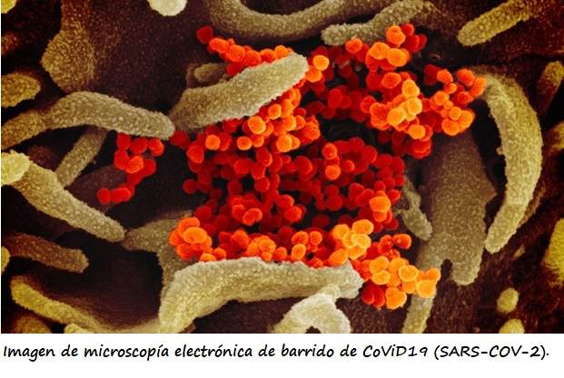 Imagen de microscopía electrónica del CoViD19