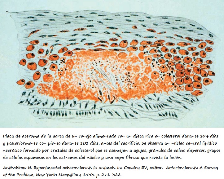 Placa de ateroma en la aorta de conejo (dibujo original de N. N. Anichkov) Corte longitudinal de la aorta de conejo donde se observa la lesión ateroesclerótica tras la administración de una dieta rica en colesterol