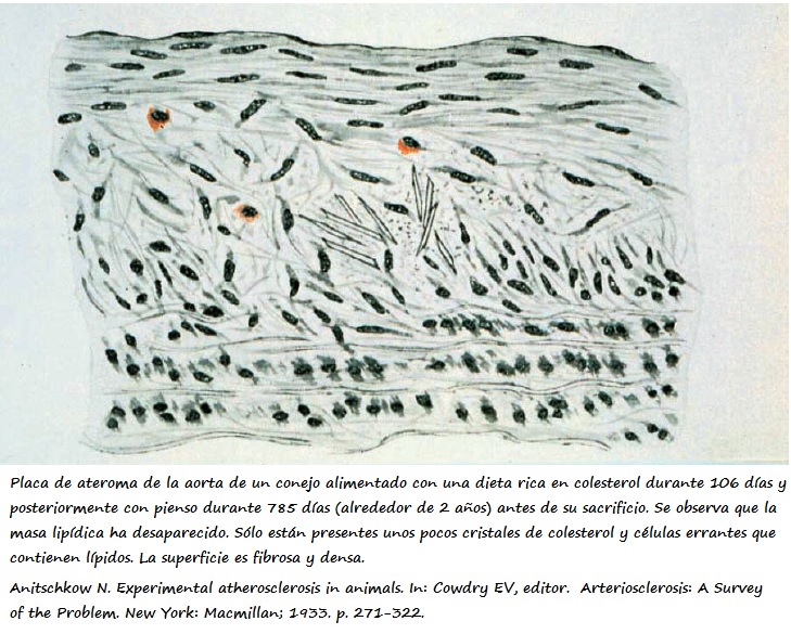 Placa de ateroma disminuida en la aorta de conejo (dibujo original de N. N. Anichkov) Corte longitudinal de la aorta de conejo donde se observa la disminución de la lesión ateroesclerótica tras la administración de pienso