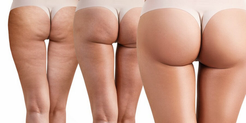 Glúteos femeninos