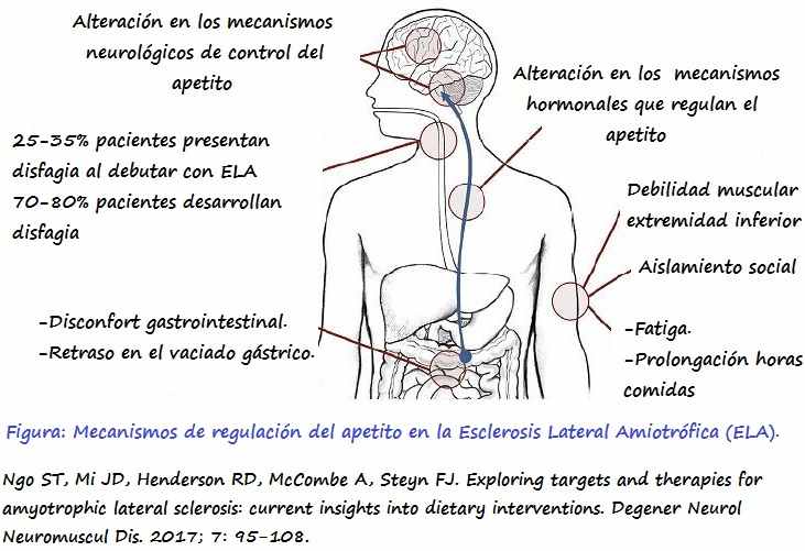 Factores nutricionales alterados en la ELA 