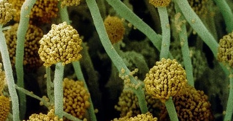 Rhizopus oligosporus Imagen de microscopía electrónica del hongo Rhizopus oligosporus