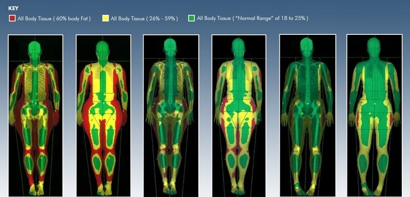 Imagen de la composición corporal estimada por DEXA de un sujeto tras una intervención nutricional de 12 semanas