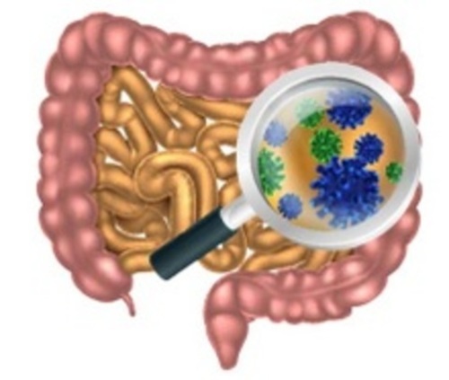 ¿Qué es la microbiota intestinal? 