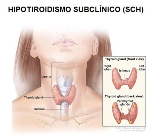 Hipotiroidismo Subclínico (SCH)