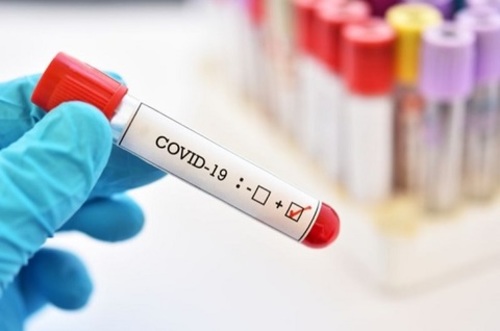 Alimentación sin bulos en el CoViD19: Documento de educación nutricional 