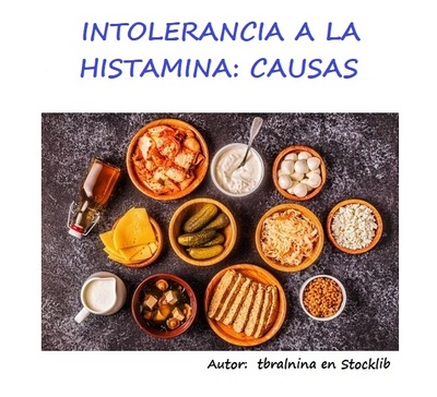 Intolerancia a la histamina: Causas